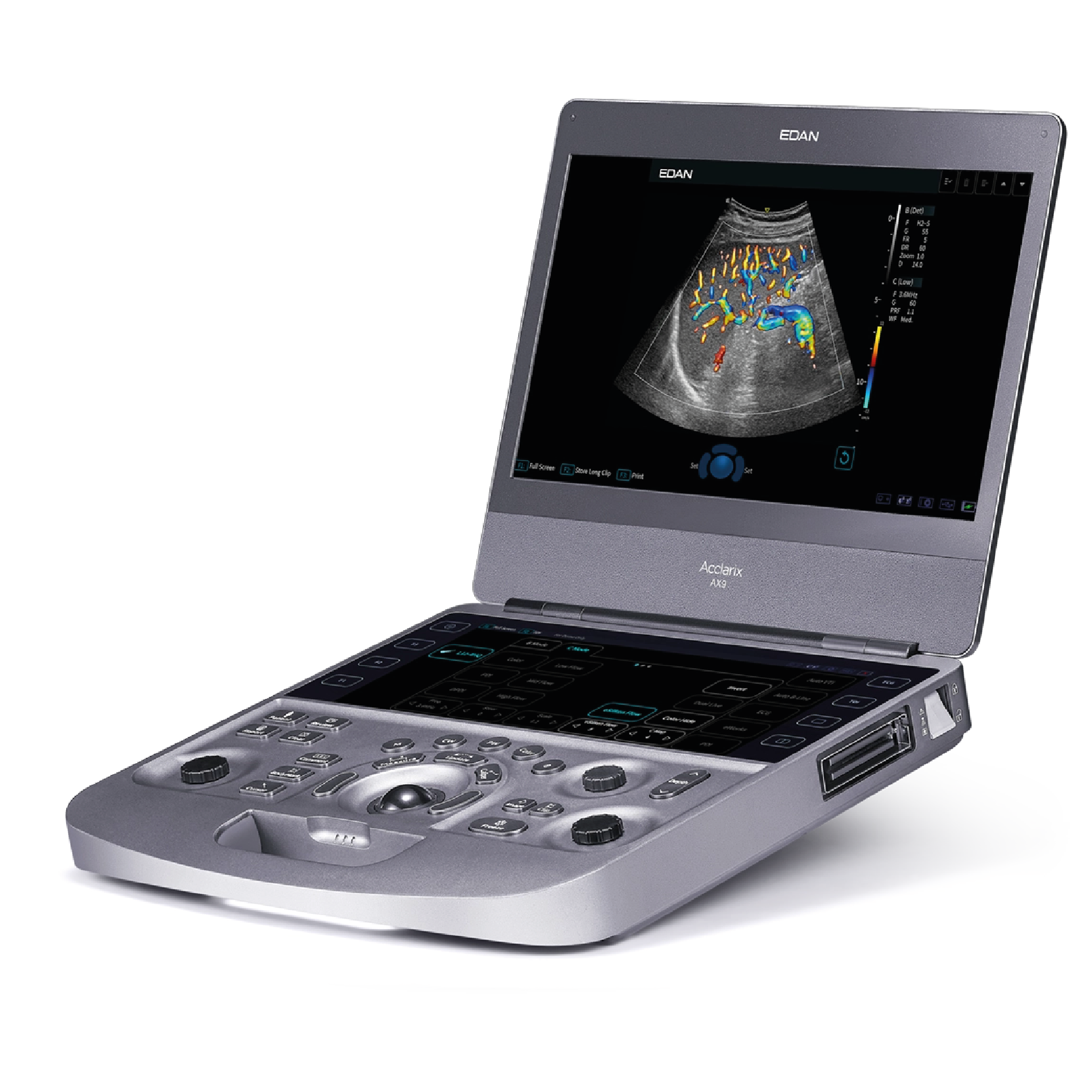 Acclarix AX3-echografie