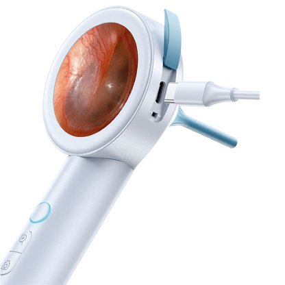 Otoscope portable
