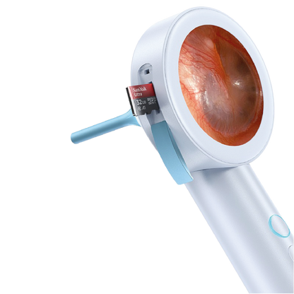 Otoscope portable