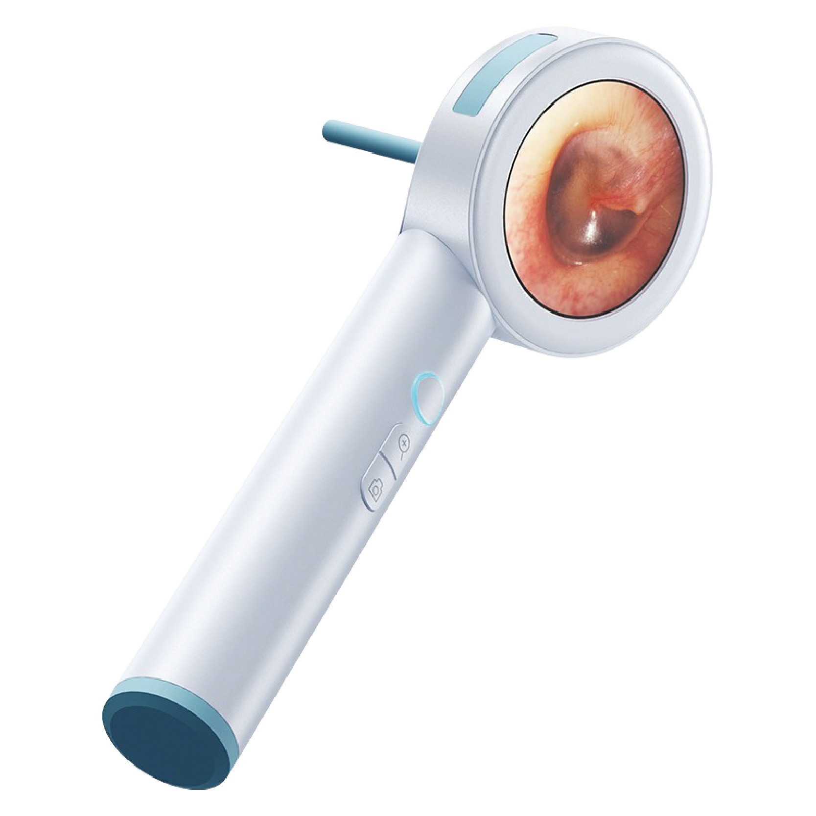 Otoscope portable