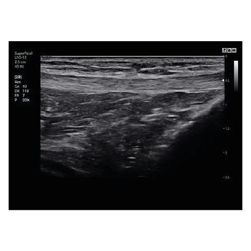 Echograaf Samsung HS30