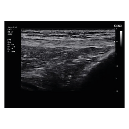 Echograaf Samsung HS30