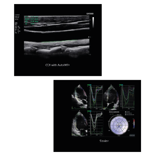 Echograaf Samsung HS30