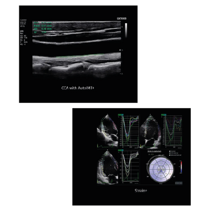 Echograaf Samsung HS30