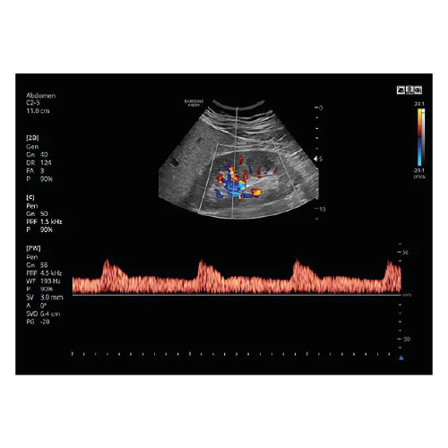 Echograaf Samsung HS30