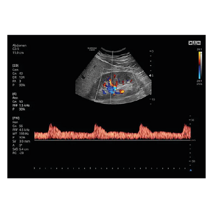 Echograaf Samsung HS30