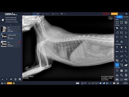 Radiographie Dynavue Duo